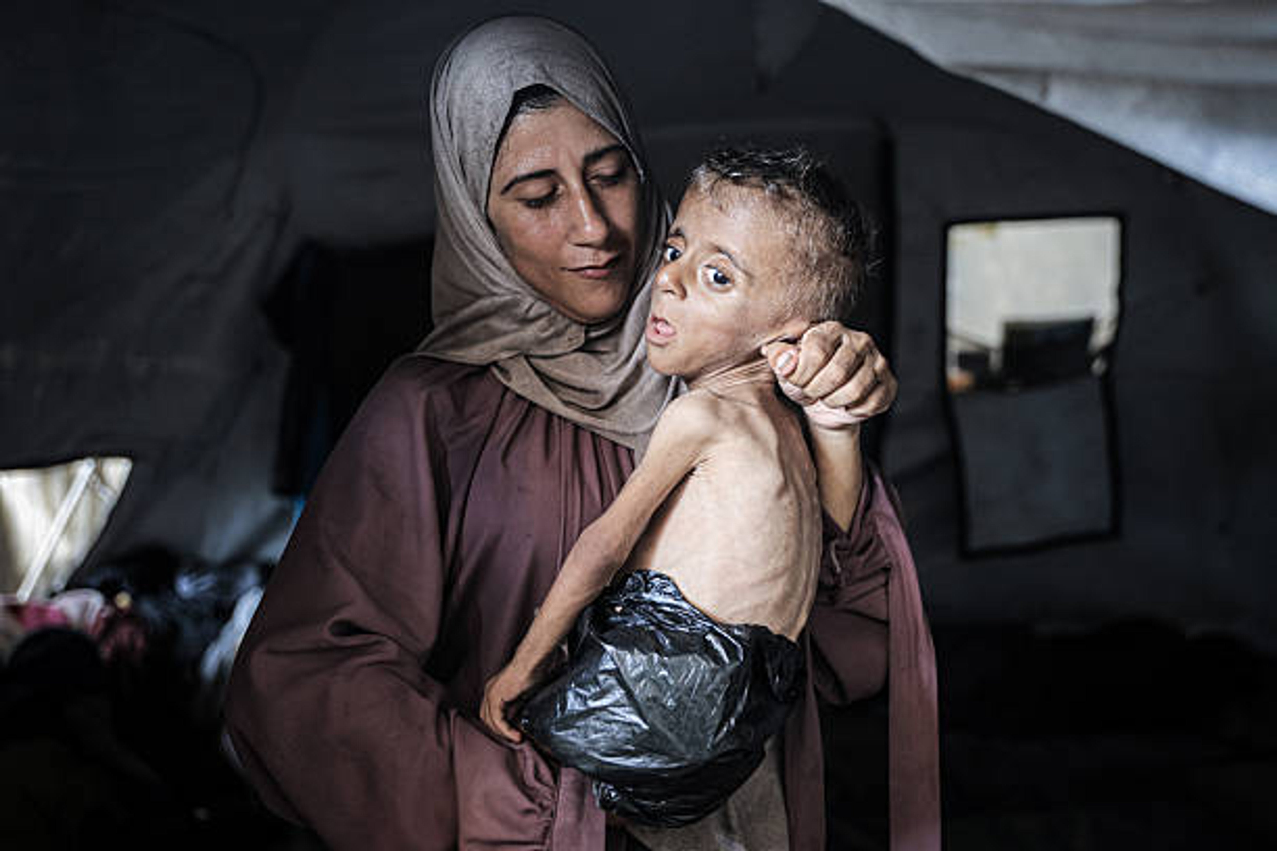 Gaza Faces Catastrophic Famine as Children Die of Starvation Amid Aid Blockades