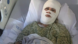 Savannah Park Chemical Attack